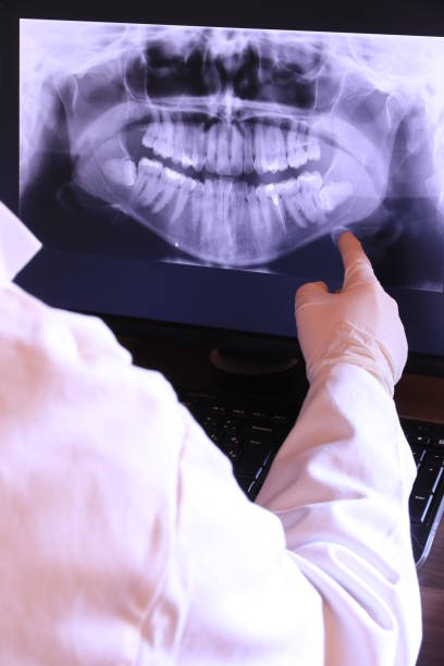 Best Emergency Wisdom Teeth Removal in Terville, WA